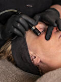 Diamond Touch - Microdermabrasie