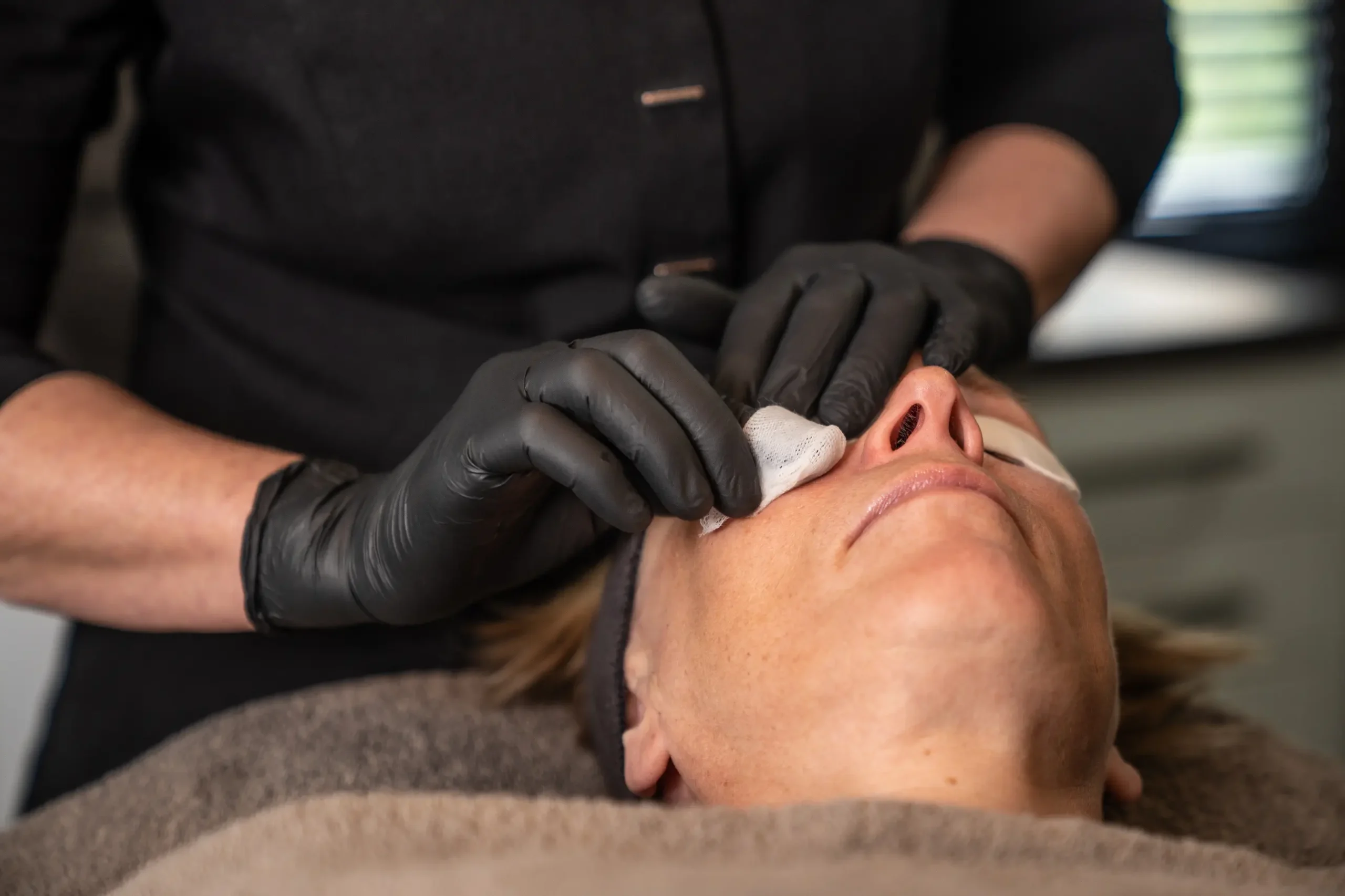 Petraas huidverbetering en agemanagement